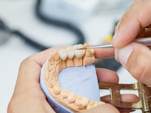 a lab technician working on a dental bridge