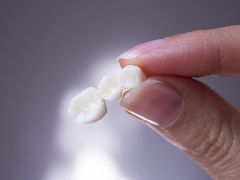 a person holding a dental bridge